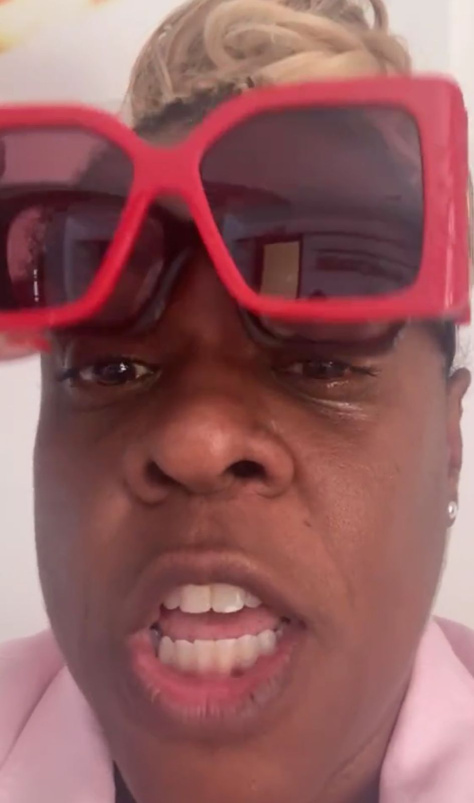 Susto! Cacau Protásio Perde Visão e Muda Cor do Olho Por Pomada de Cabelo; Atriz Faz Alerta!