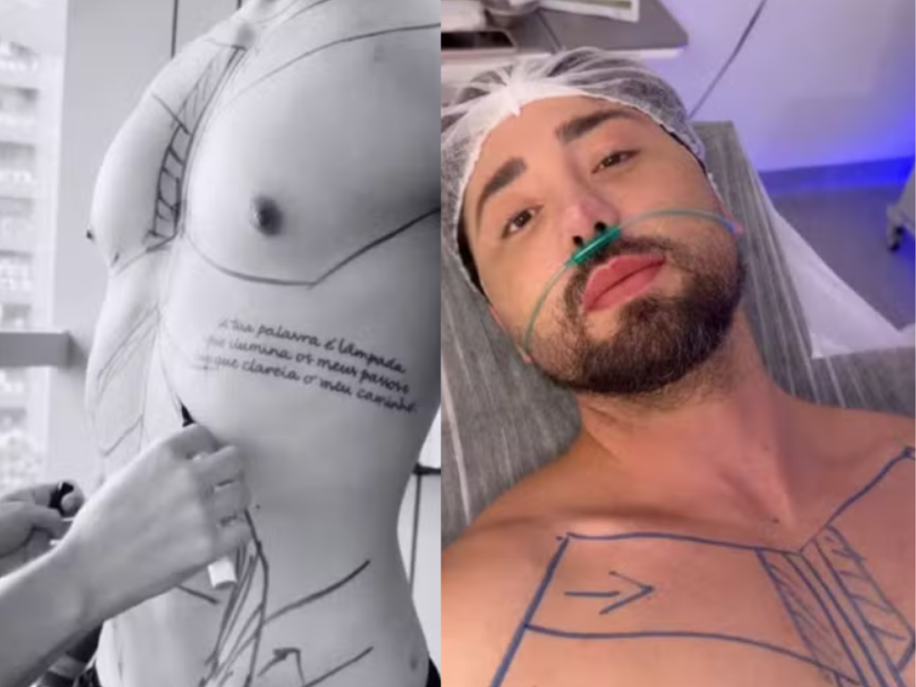 “Sou do centro cirúrgico”: Rico Melquiades investe R$ 150 mil em novas plásticas para “nova skin”