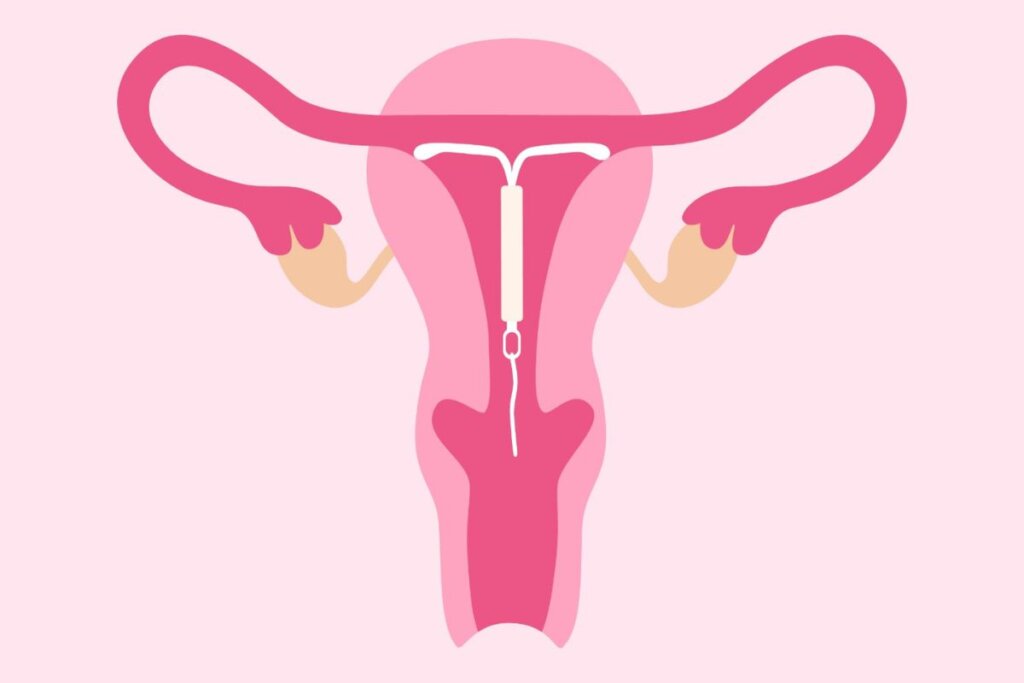 DIU e Sexo: Guia Farofa para uma Retomada Segura e Prazerosa da Intimidade!
