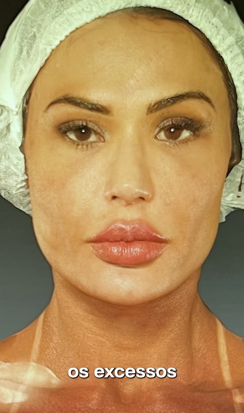 Gracyanne Barbosa ‘turbina’ a região íntima com combo estético!