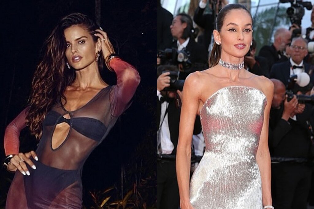 Bafão em Cannes: Izabel Goulart Surge Diferente e Médicos Avaliam Mudanças
