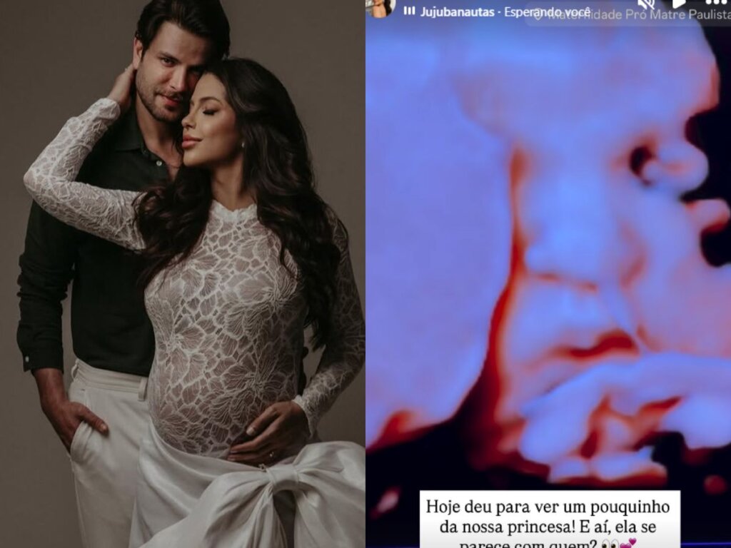Laís e Gustavo, do BBB 22, mostram a filha em ultrassom 3D e derretem a web!