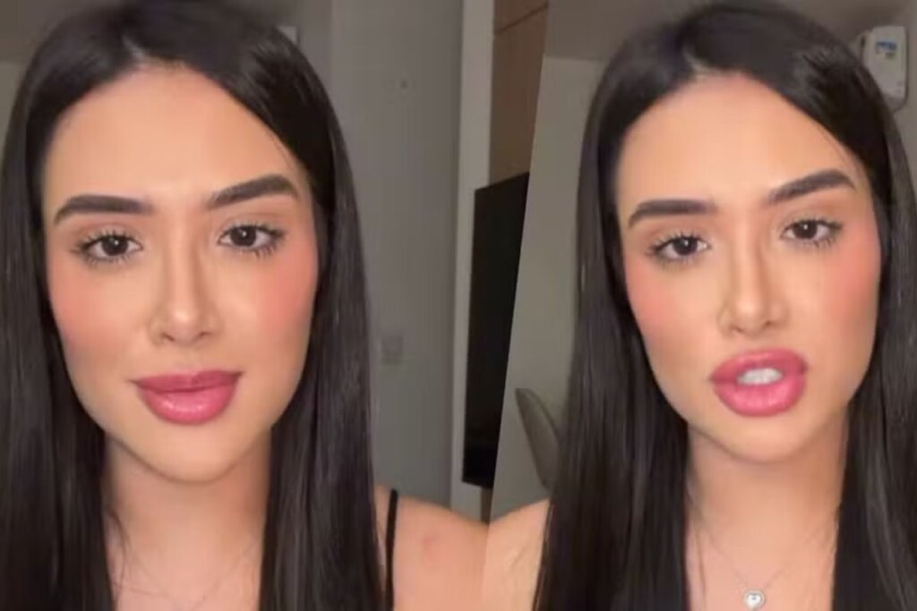 Chega de polêmica! Ex-BBB Jordana revela uso de ácido hialurônico para ‘uniformizar textura’ dos lábios, não aumentar volume