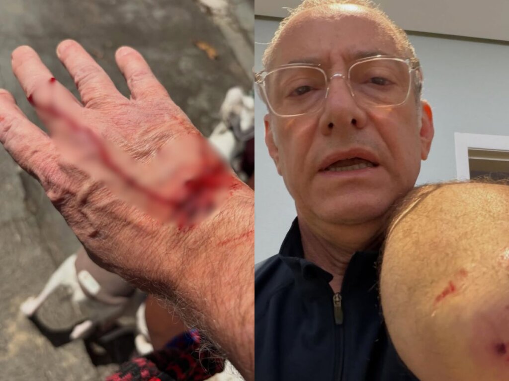 Quase Atropelamento Ao Vivo, Rato Morto e Mais: A Semana MALUCA da TV Brasileira!