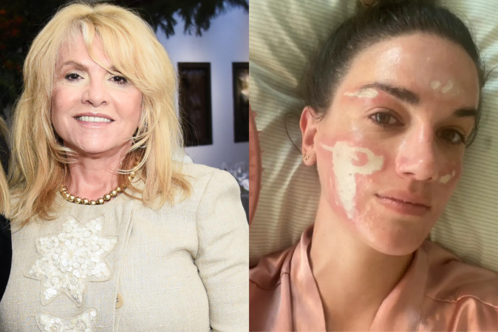 OMG! Esteticista de Madonna e Kim Kardashian Perde Licença Após Deixar Cliente Cicatrizada!