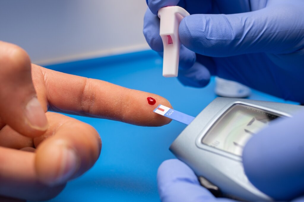 O Açúcar no Seu Sangue Está Destruindo Suas Artérias? Médico Explica!