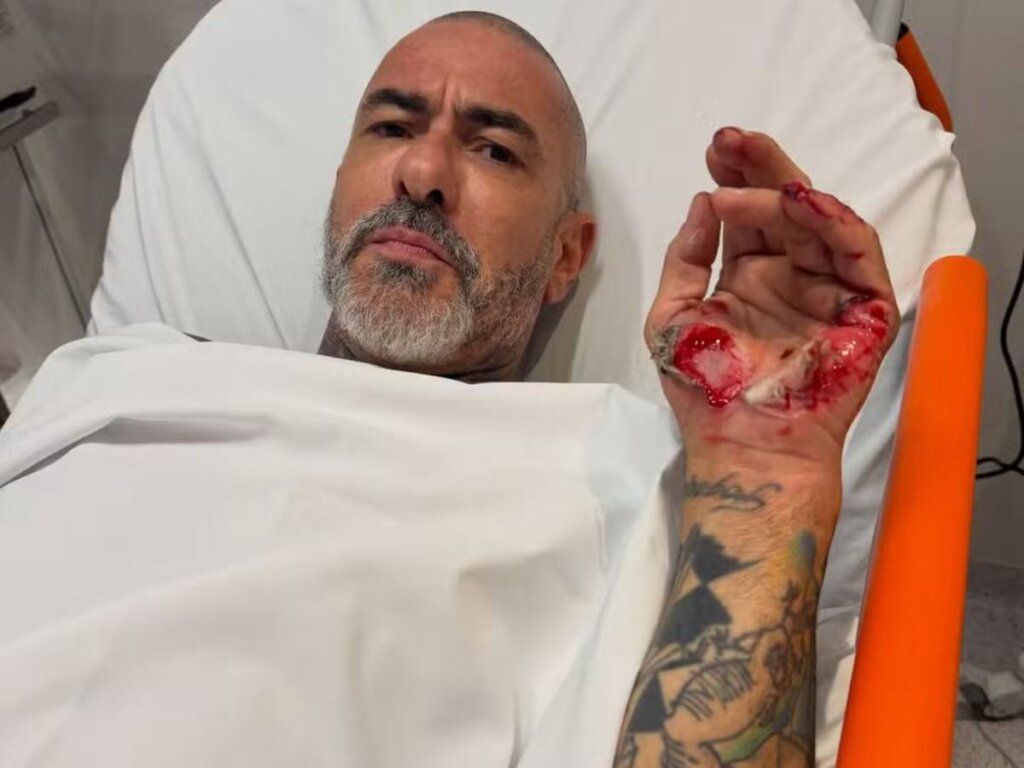 Fogaça Expõe Feridas Após Acidente e Revela Roubo Chocante em Hospital!