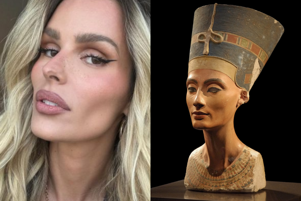 Pescosso de Diva: Dentistas Revelam o Poder do Botox para um Contorno Facial Perfeito!