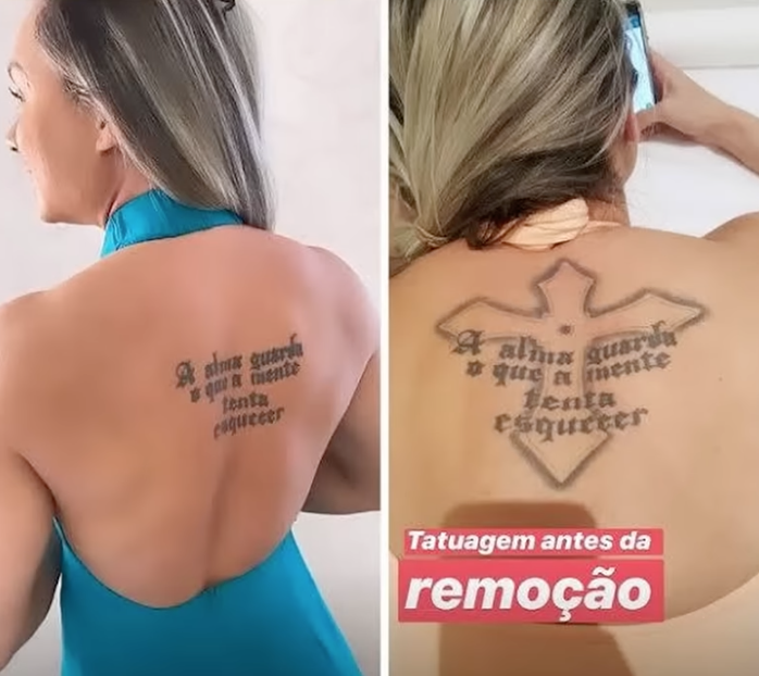 Juju Salimeni Abre o Jogo Sobre Remoção de Tatuagem de Uma Década!