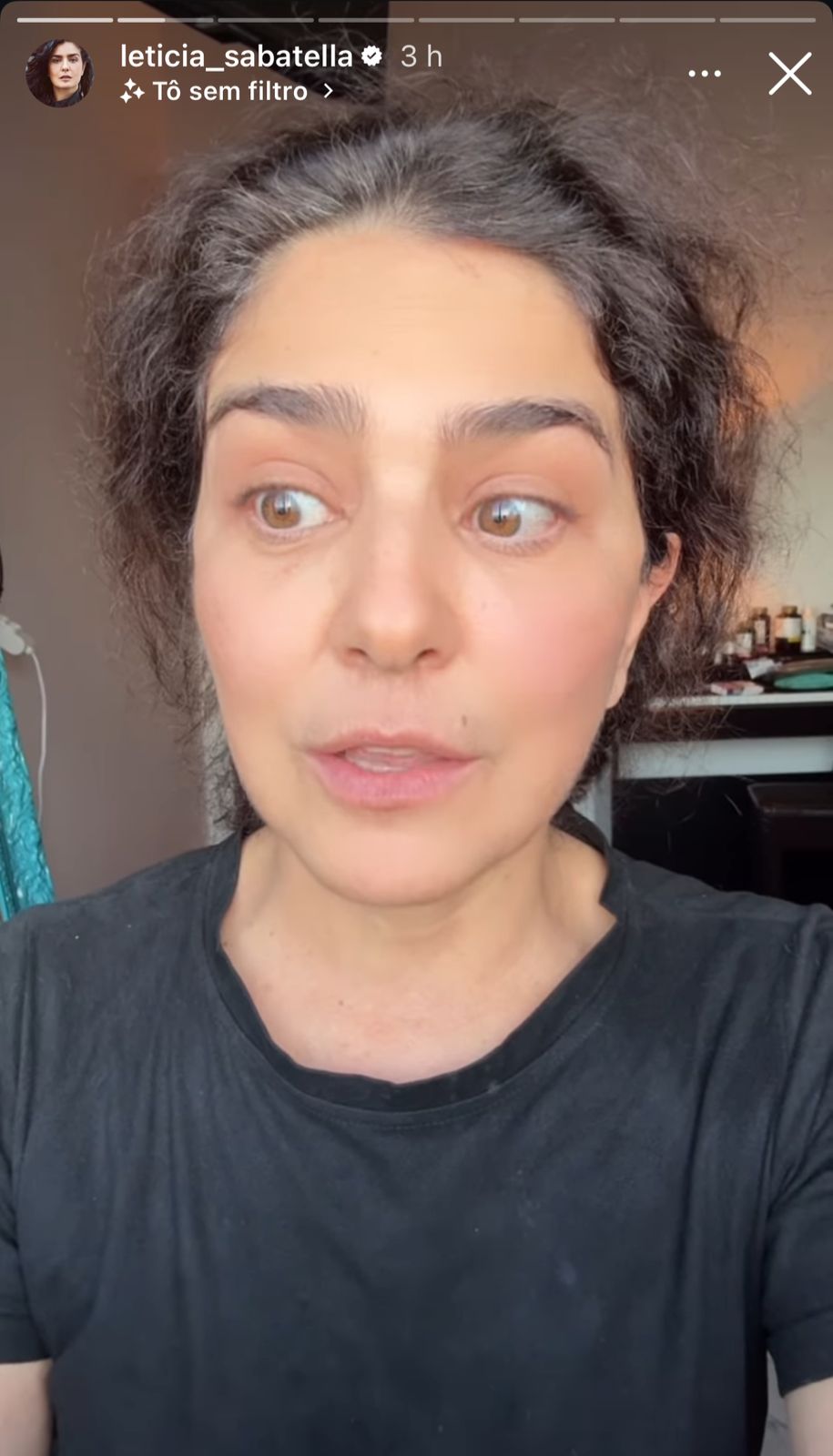 Justiça do Rio dá um basta no drama pet de Letícia Sabatella!