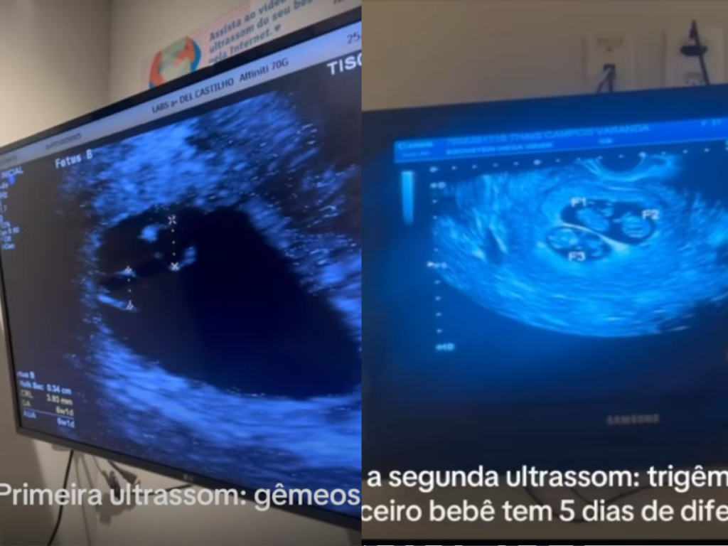 Choque no RJ! Grávida de Gêmeos Engravida de Novo e Espera TRÊS Bebês!