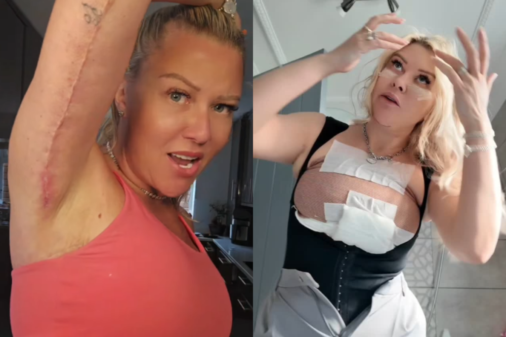 Chocante! Mulher faz cirurgias até na vagina e se autodenomina ‘Noiva de Frankenstein’