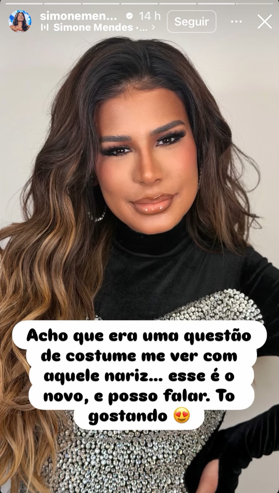 Simone Mendes exibe nariz ‘novo em folha’ após críticas e faz revelação!